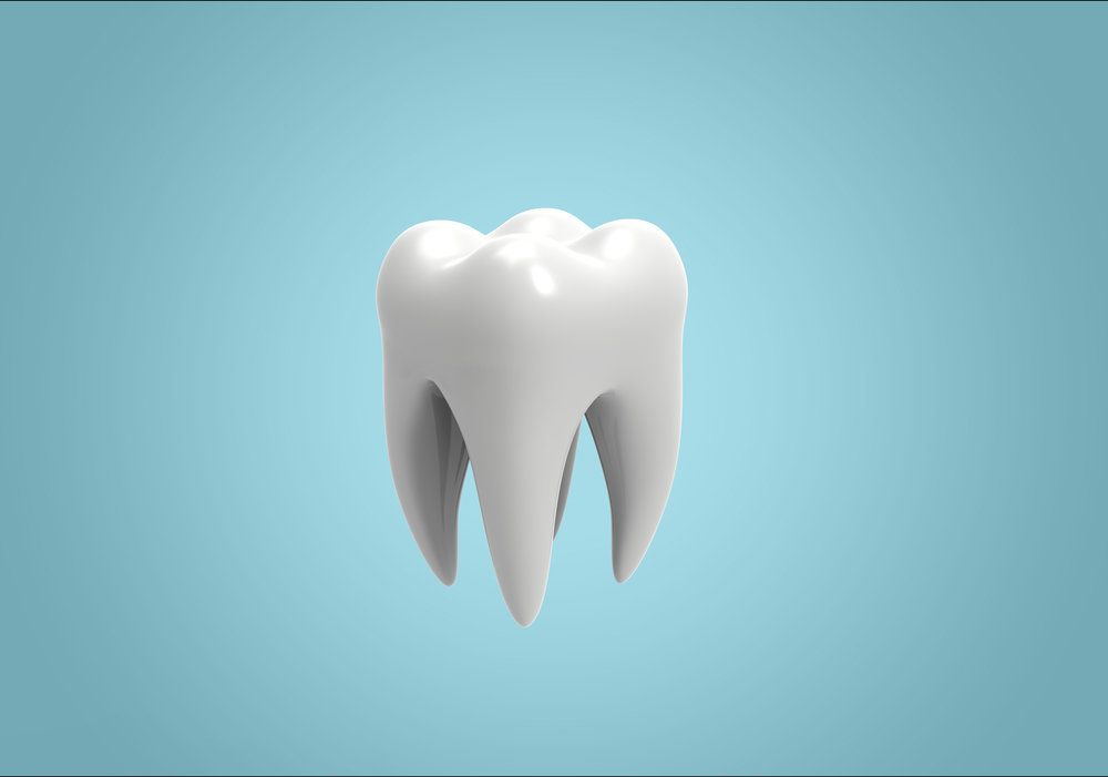 3D graphic of a wisdom tooth molar.