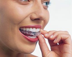 Woman removing clear aligner tray