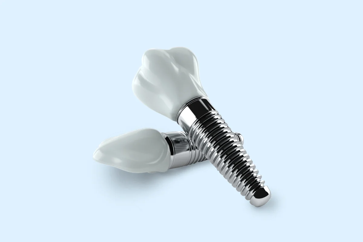 History of Dental Implants